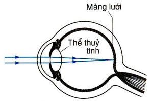 cấu tạo của mắt